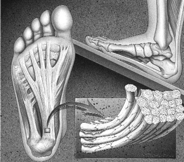 concluded that the plantar fascia was the most important support structure (Huang et al., 1993; Thordarson et al., 1995). Figure 7. The plantar fascia (Young et al., 2001).