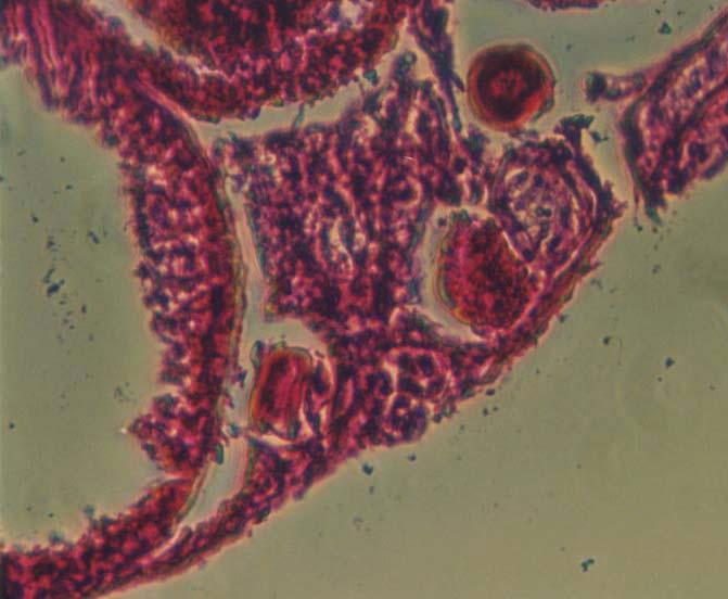 T C C A 2µm C B L 10µm Figure 12 Ovaries from 72T Bettas exhibiting testicular tissue. A. 200X; B. 100X; Spermatocysts (C); Lumen (L); Tertiary Yolk Globule Stage (T); Atretic oocytes ().