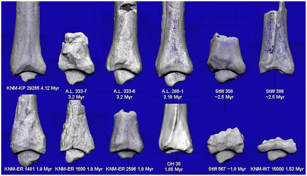 Human Foot Arch Evolution Figure 5. Correlation between tibial arch angle and measures of flat foot in humans.