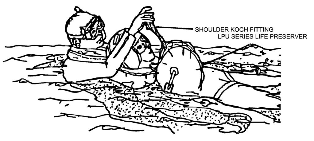 Figure 3-23. The RS Releases the Koch Fittings about the Survivor s Shoulders Figure 3-24.