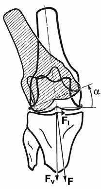230 Optimal stance ski-boot through integrated design environment (a) (b) (c) Figure 1. Varus-valgus angle and related medial collateral ligament injury (a).