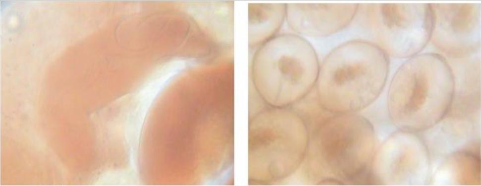 FIGURE 9- Showing eggs FIGURE 10- showing terminal end of intestinal caecae FIGURE 11- Showing terminal end of