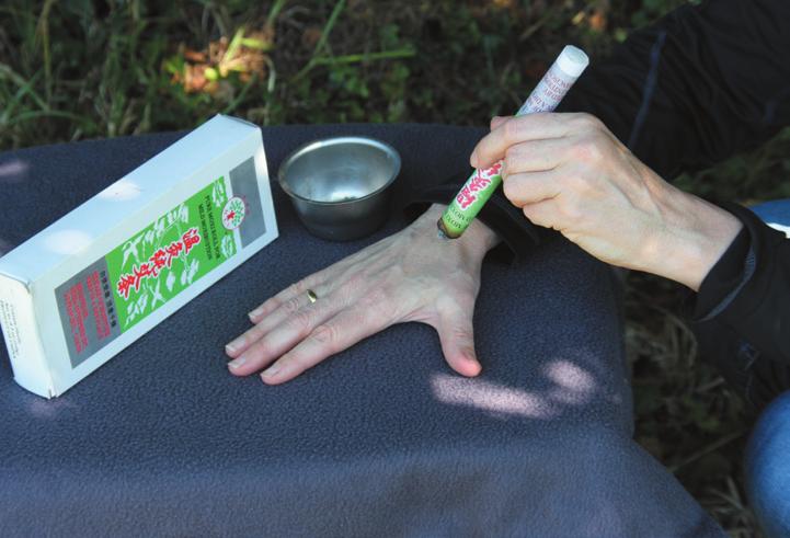 Moxa sticks are made from dried mugwort (artemisia vulgaris) rolled into a cigar shape. Moxa sticks are inexpensive and readily available online.
