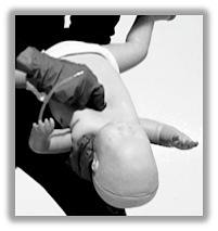 Thump the infant gently but firmly 5 times on the middle of the back, between the shoulder blades use the heel of your hand. Hold the infant face-up on your forearm with the head lower than the heart.