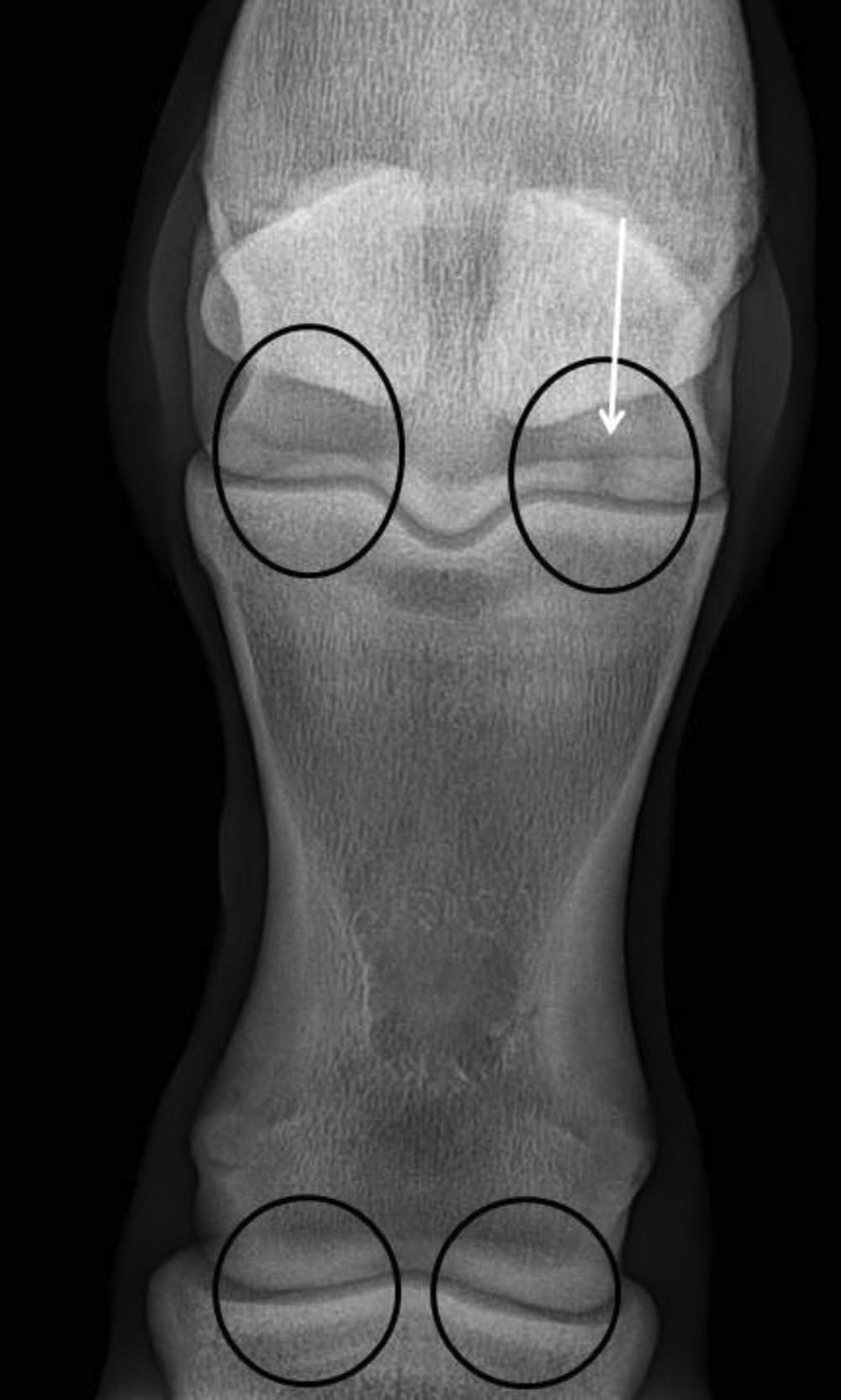 Fig. 2. Fetlock joint lateral to medial projection. This horse has moderate (3- to 4-mm) supracondylar lysis of the distal metacarpus (arrow). This radiograph will be discussed by the panel as Case 2.