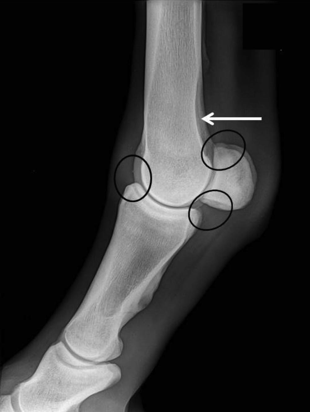 (4) Supracondylar lysis of MC/MT3 (5) Apical sesamoid fragments (6) Palmar/plantar proximal P1 fragments Lateral to medial (flexed) projection of the fetlock joint (Fig. 3).