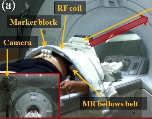 Audiovisual (AV) biofeedback improves anatomical position management in breath-hold (b) Taeho Kim, Sean