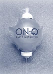 WHAT IS THE ON-Q* PUMP? The ON-Q* Pump is a balloon type pump filled with a medicine to treat your pain.
