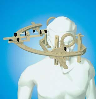 stereotactic arc, permits full flexibility in terms of access to all intracranial areas.
