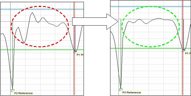 Section 3: Commissioning Reference Manual Figure 3-1. Echo curve before and after TNZ TNZ NOTE: The effect of TNZ is only visible when an echo is present in the near zone. 3.3.2 Changing the Upper Null Zone (UNZ) Measurements are not performed within the Upper Null Zone (UNZ).