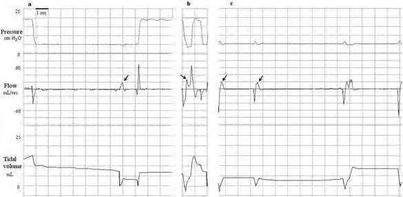 (b) In this recording ten consecutive inflations can be seen. In this CI the V Te varies between 5 7 ml/kg and there is minimal facemask leak. 6 Figure 2. Three examples of breaths.