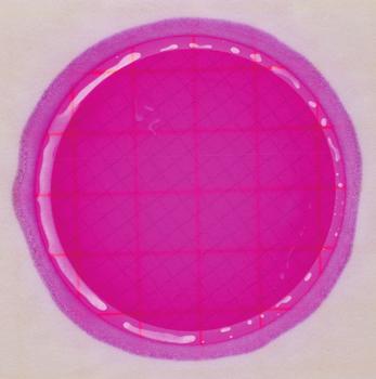 Figure 2 AQEB plate with low count Count: 2 cfu Observation: Enterobacteriaceae are identified by the presence of acid (yellow halo) and/or