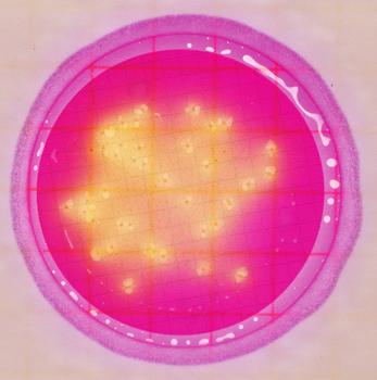 Figure 3 AQEB plate with high count Count: 17 cfu Observation: Red colonies without acid or gas production (circle) are not counted as