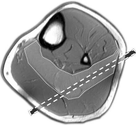 674 K Brauck and others EUROPEAN JOURNAL OF ENDOCRINOLOGY (2007) 156 Using a phase-contrast (PC)-based MRI imaging technique, MRE visualizes and quantitatively measures propagating acoustic strain
