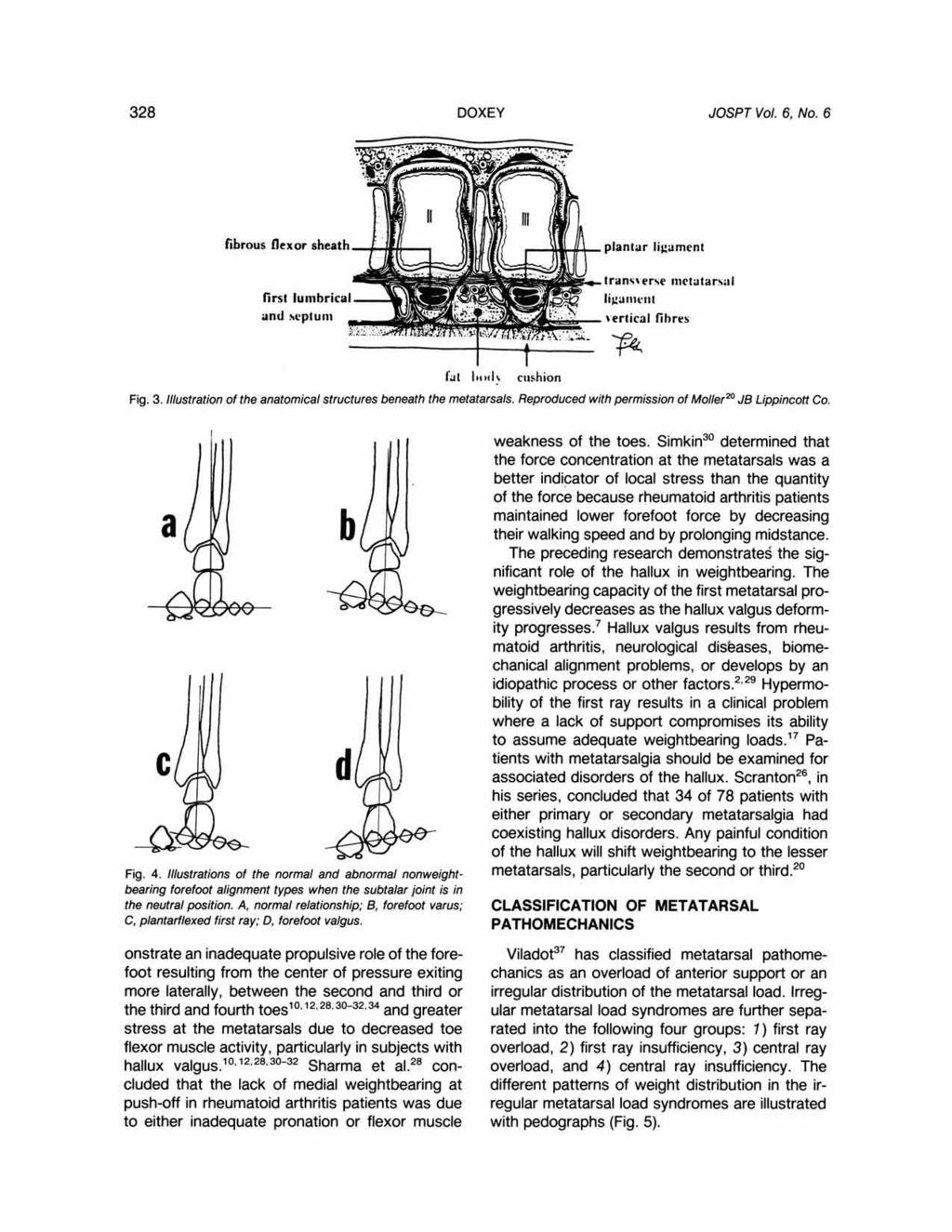 DOXEY JOSPT Vol. 6, No. 6 fibrous flexor sheath lirst lunibrical and scptunl plantar ligament trancrerse mctatars;~i liga~~~t*t~t vertical fihres R Fig. 3.
