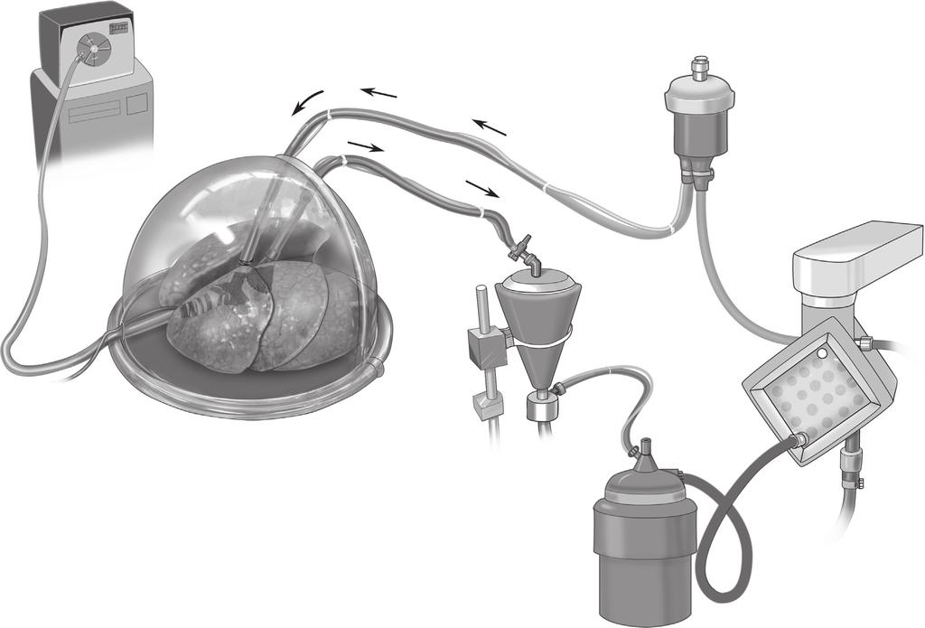 Ex vivo lung perfusion 441 Ventilator To PA From LA Leukocyte filter Hard
