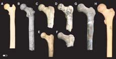 Like other early hominin femora (C to F), BAR 1002'00 (B) is distinct from those of modern humans (H) and great apes (A) in having a long, anteroposteriorly narrow neck and wide proximal shaft.