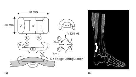 force development that can describe the loading characteristics of the tendon in normal locomotion. 29 FIGURE 17.