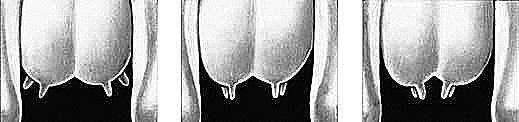 Teats (fig. 13) 3 points Cylindrical shape and uniform size with medium length and diameter. 7. Udder balance and texture 3 points Should exhibit an udder floor that is level as viewed from the side.