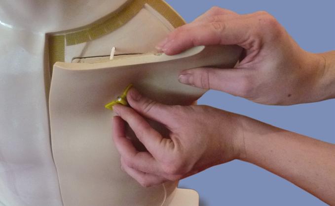 Proper Use of your Chester Chest Chest Tissue Flap - 0405 When removing the Chest Tissue Flap, always pull gently from the edge to prevent damage to the flap.