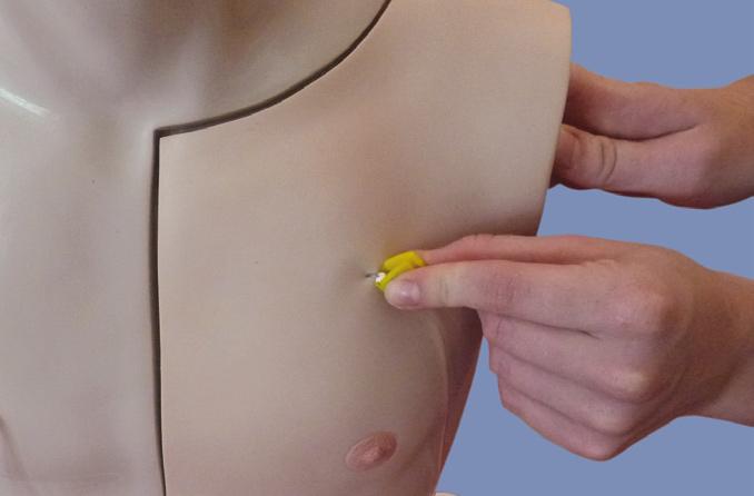 There are three areas that should be avoided, as all can cause premature tearing of the Chest Tissue Flap: Do not pull the Chest Tissue Flap back to view the placment of the needle in the port septum