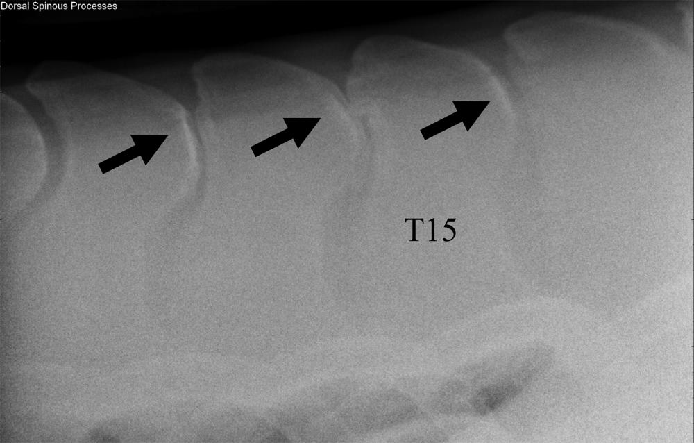 Fig. 1. Radiograph showing typical kissing spines (black arrows). relative to the anticlinal thoracic vertebrae (T15).