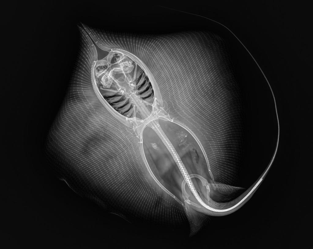 Contribution to the taxonomy and distribution of eight ray species (Chondrichthyes, Batoidea) from coastal waters of Thailand 261 Figure 8 Dasyatis zugei, ZMH 25689: Radiograph of the 210 mm