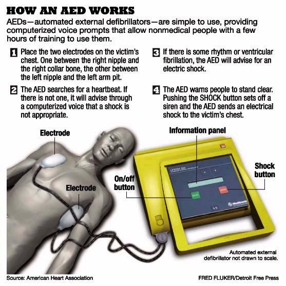 Figure 8-2. How the AED works. 8-2. PROCEDURES FOR INTEGRATING THE AUTOMATED EXTERNAL DEFIBRILLATOR AND CARDIOPULMONARY RESUSCITATION It is important to know how to integrate the AED into the CPR sequence.