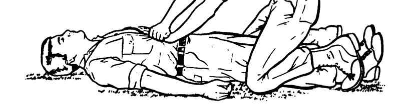 Figure 5-6. Administering a modified abdominal thrust to an unconscious casualty.