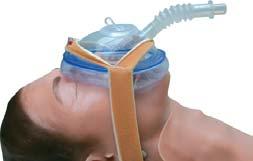 Masks Endoscopy Masks Allow simultaneous ventilation and endoscopy of the patient to increase patient comfort and the working quality of the doctor.