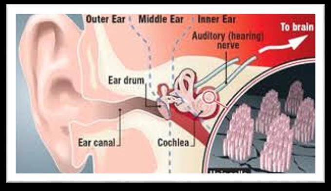 Module 7: Hearing Protection What's the noise all about? Most of us take hearing for granted. When we go home at the end of a workday and when we get up in the morning, we expect to hear well.