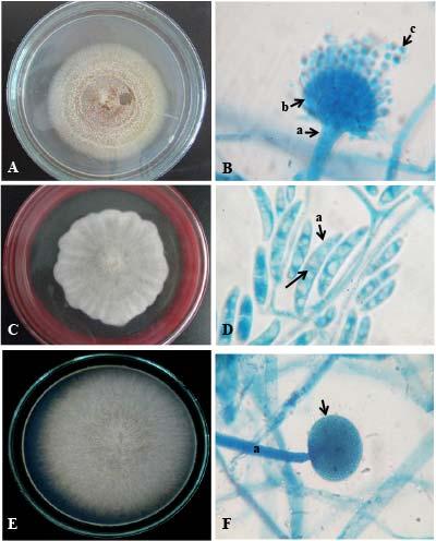 Hình 3: Đặc điểm hình thái vi nấm nhiễm trên cá tra giống A: Khuẩn lạc Aspergillus sp.