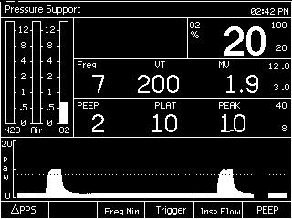2 The Waveform window is replaced by the ventilator settings window and a message that provides instructions to confirm the mode change.