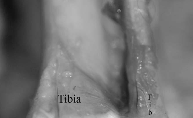Figure 5.5. Anatomy of baboon (Papio anubis) ankle.