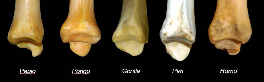 Figure 5.8. Comparative morphology of anthropoid medial malleoli. Figure 5.8. Distal tibia in lateral view of (from left to right) Papio anubis, Pongo pygmaeus, Gorilla gorilla gorilla, Pan troglodytes, and Homo sapiens.