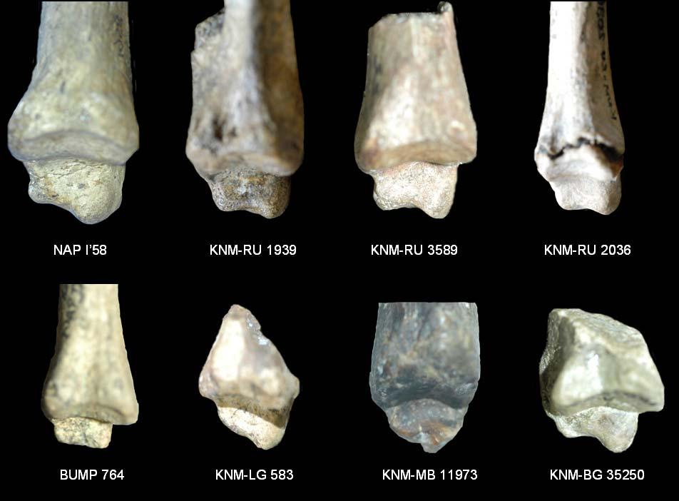 Figure 5.11. Comparative morphology of Miocene catarrhine medial malleoli. Figure 5.11. Eight relatively complete distal tibia from catarrhines of the early to middle Miocene in lateral view.