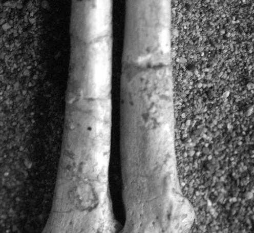 Figure 7.13. Lateral aspect of Proconsul nyanzae (KNM-RU 5872) midfoot. Figure 7.13. Articulated cuboid, and 5 th and 4 th metatarsals from the Proconsul nyanzae foot KNM-RU 5872 in dorsal view.