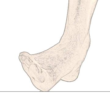 is the meeting point of the talus (ankle bone) and the calcaneus (heel bone).