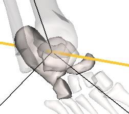 So it is an unstable joint and therefore, ligaments must provide strong further support to limit the mobility of the