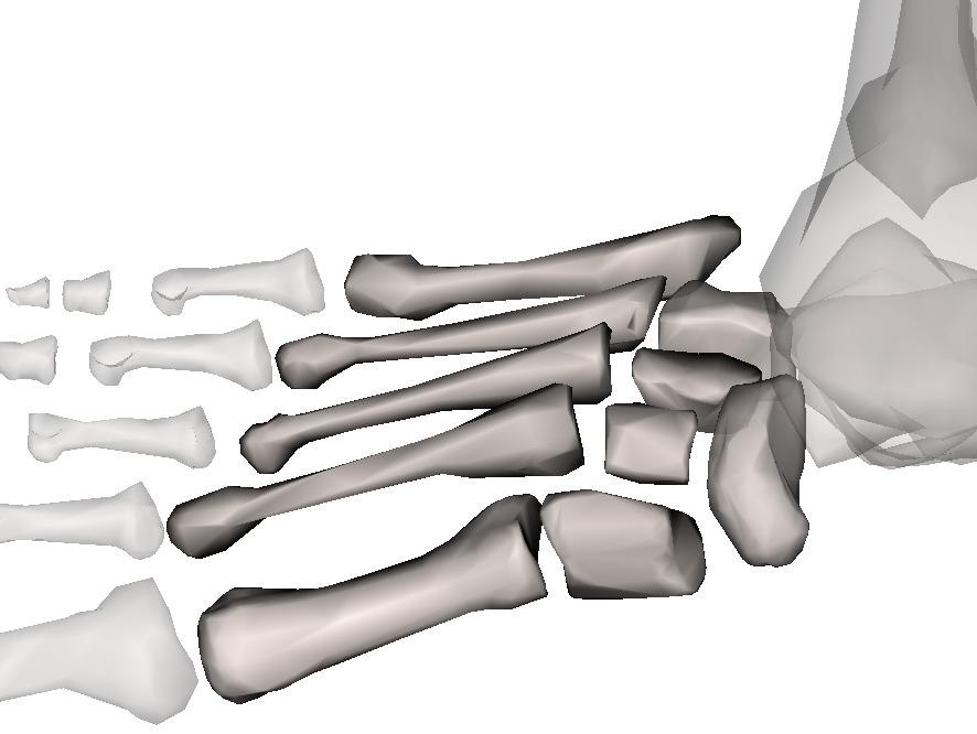 Figure 3.8: Foot midtarsal joint The first transverse axis is for the first and second MTP joints and the second oblique axis is for the third, fourth and fifth MTP joints.