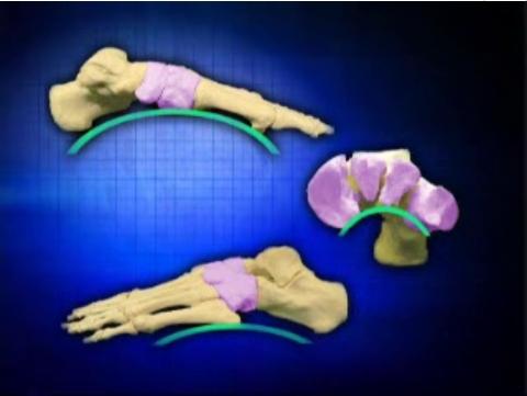 they also help to maintain the arches of the foot during weightbearing. Our plantar vault is often described as a three arches system. Two arches are arranged longitudinally and one transversely.