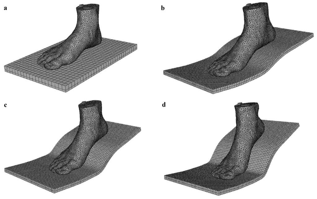 Plantar pressure distribution and internal stresses strains within bony and soft tissue structures under various supporting conditions for balance standing were predicted by the model.