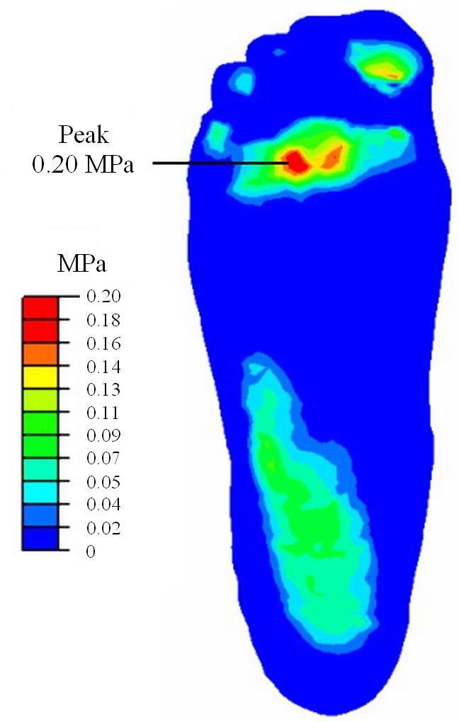 especially for 7.6 cm. The peak von Mises stress in major bones with different heel elevations are compared in Fig. 10. Peak von Mises stress appeared at plantar junction of calcaneal-cuboid joint.