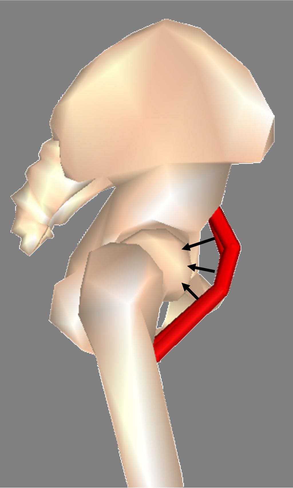 Lewis et al. Page 14 FIGURE 3. Stabilizing effect of iliacus and psoas muscles crossing the hip joint.