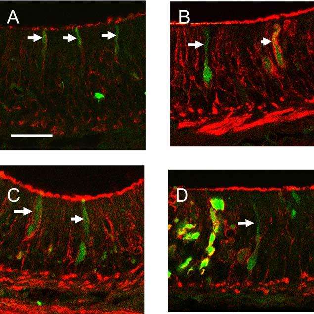 Figure 2. Confocal images of the olfactory epithelium with retrogradely labeled olfactory sensory neurons, from injections that included medial glomeruli.