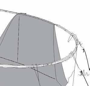 (Remove stabilizers gradually as you fold the liner over the top of the wall. )This will assure you that the liner begins going over the wall straight. (Image 7) b.