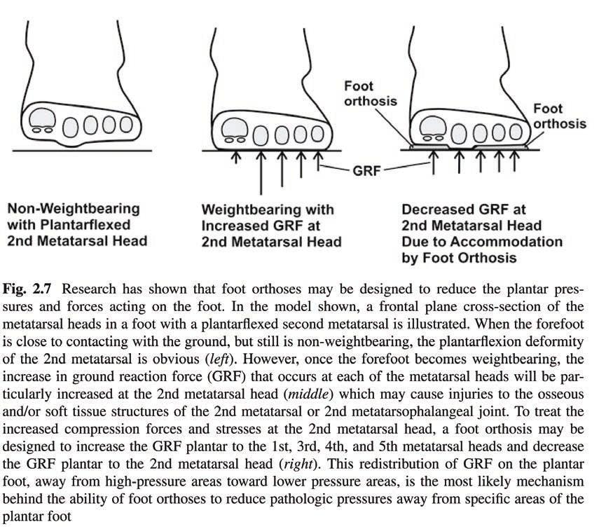 122 Sports (from page 120) ments of the foot and lower extremity during running.
