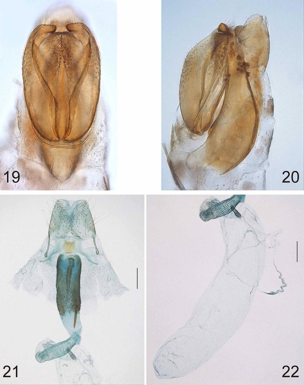 FIGURES 19 22. Urodeta absidata, sp. n. 19, male genitalia, ventral view; 20, male genitalia, lateral view. Holotype, in glycerol before permanent mounting in Euparal.