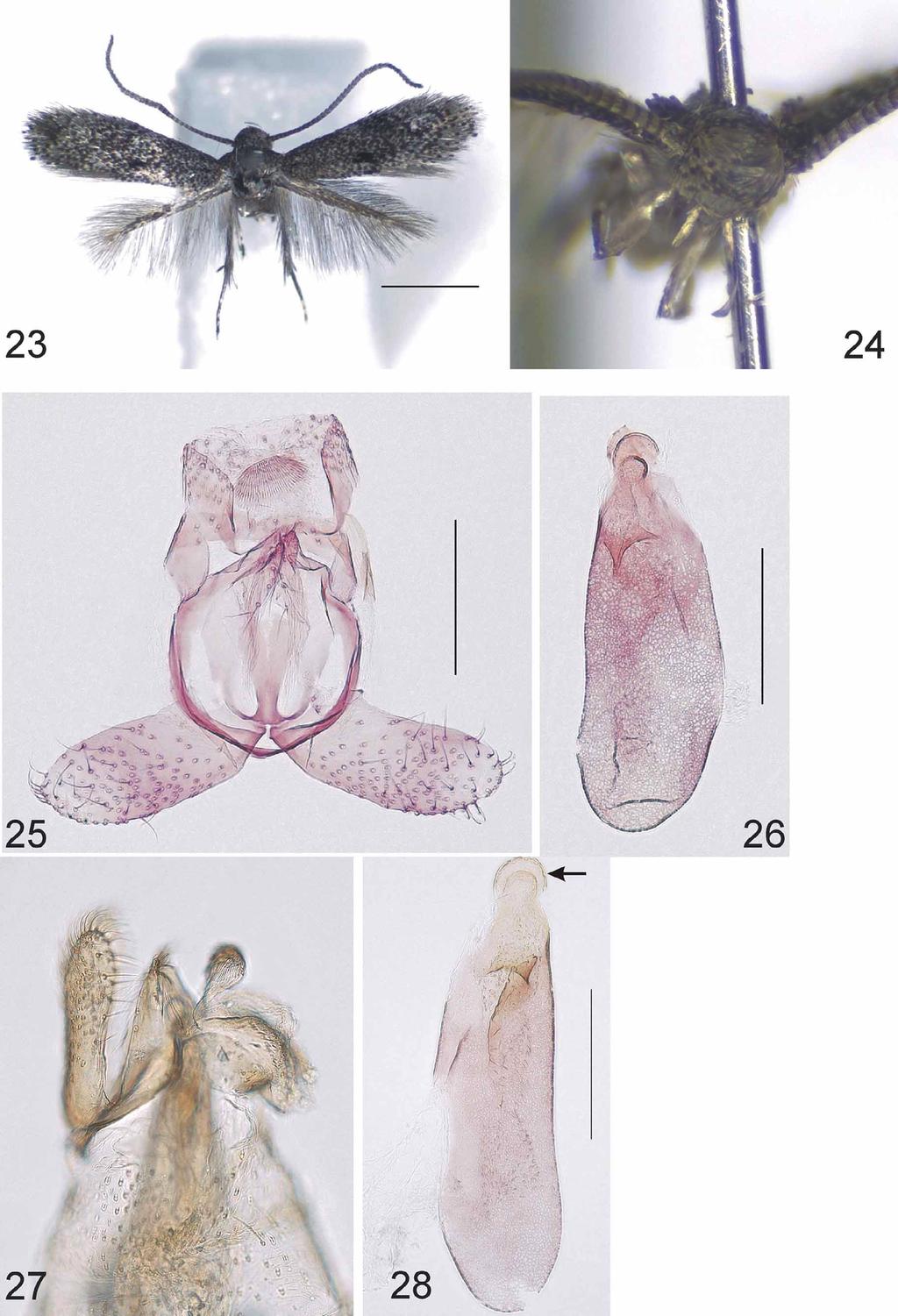 FIGURES 23 28. Urodeta acerba, sp. n. 23, adult male; 24, head, frontal view. Paratype. Specimen ID: RMCA ENT 000004120.