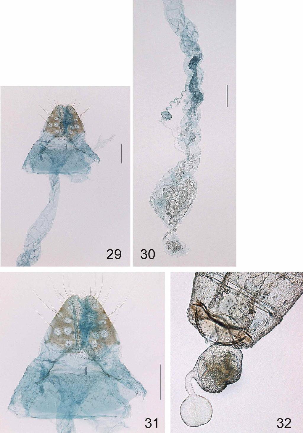 FIGURES 29 32. Urodeta acerba, sp. n., female genitalia. 29, caudal part; 30, ductus and corpus bursae; 31, caudal part, enlarged. Paratype. Gen. prep.